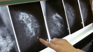 111018012923-mammogram-breast-cancer-x-ray-story-top