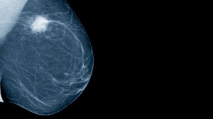 mammogram_wide-433592d93ffcbe92cb41e450d656d9ec7bcd9f6b-s800-c85